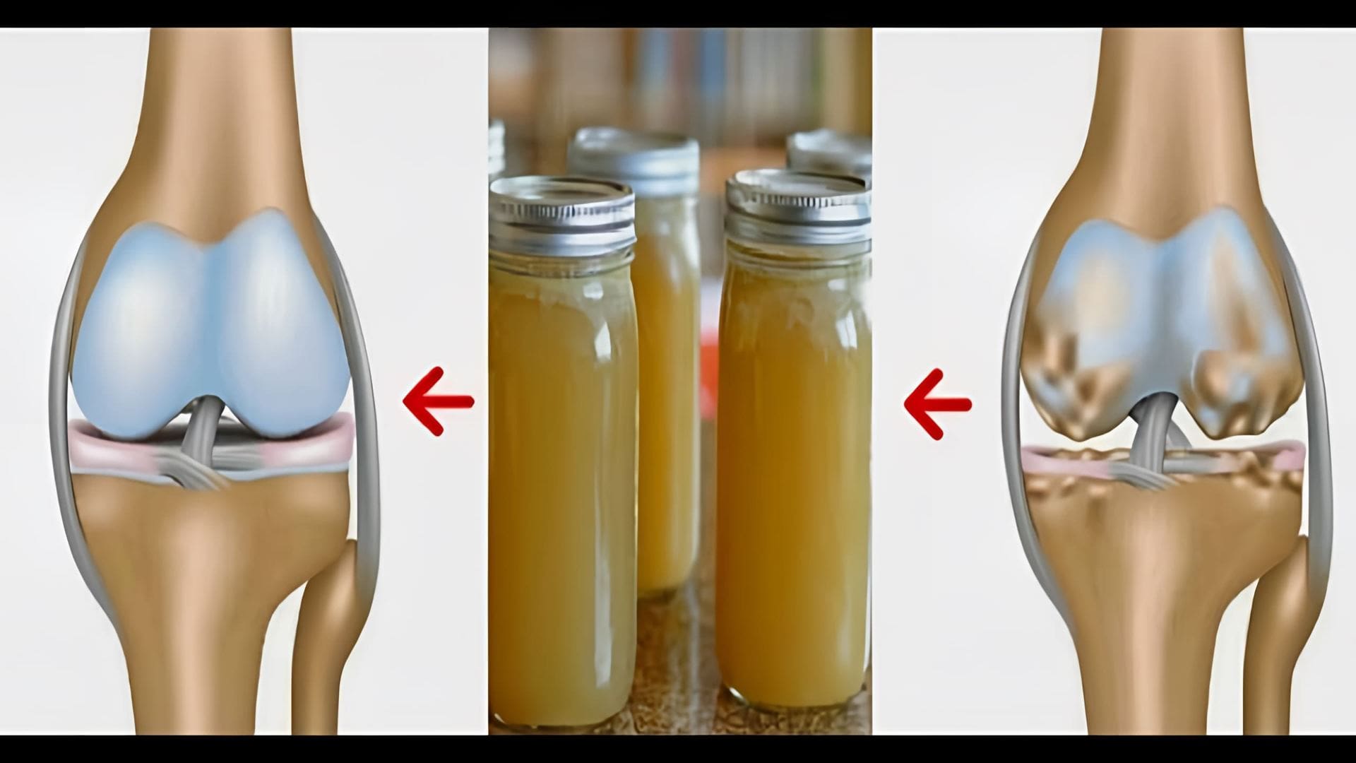 В данном видеоуроке рассказывается о лечении суставов желатином