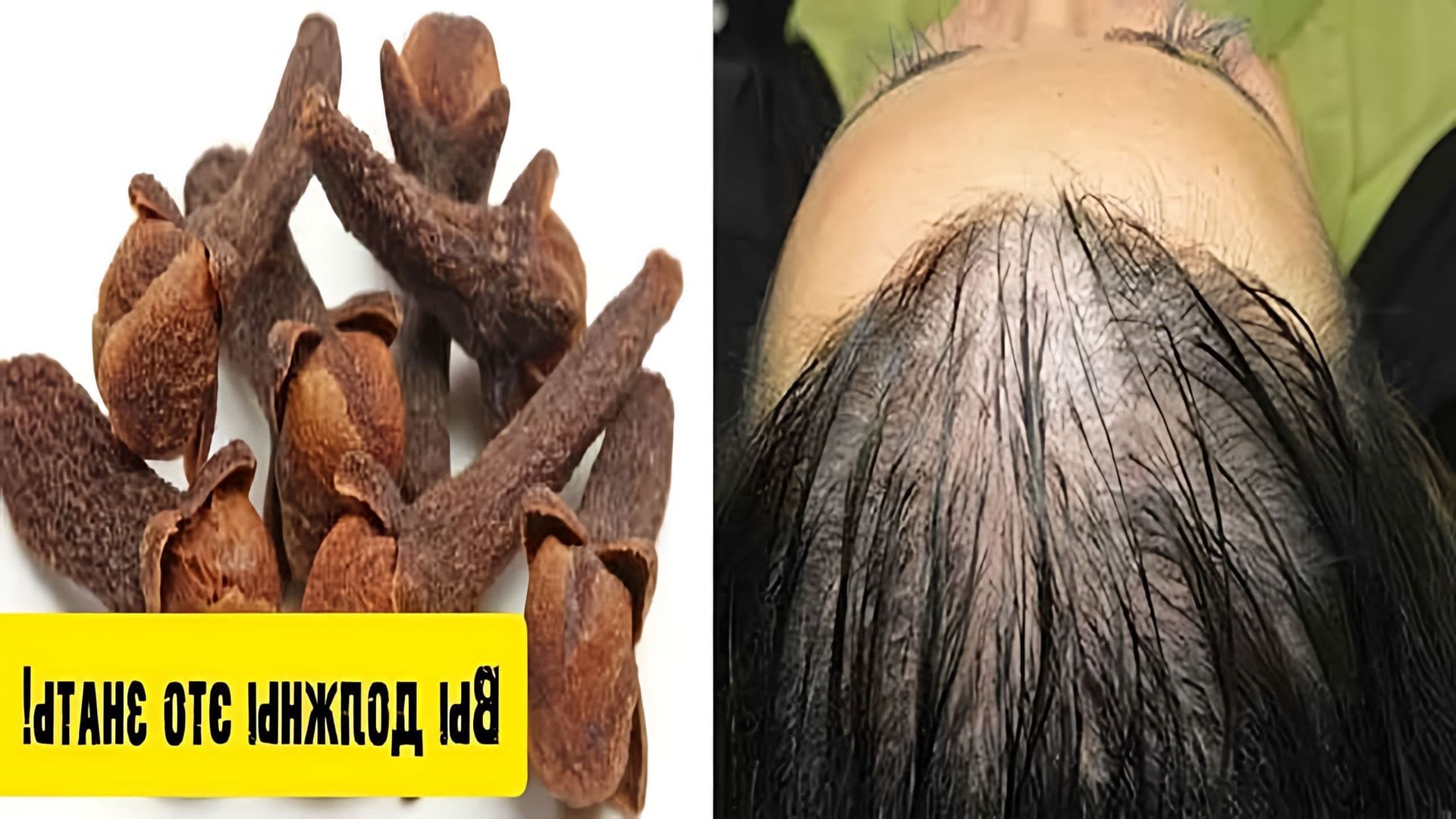 В этом видео рассказывается о том, как быстро отрастить волосы и лечить облысение с помощью индийского секрета ухода за волосами