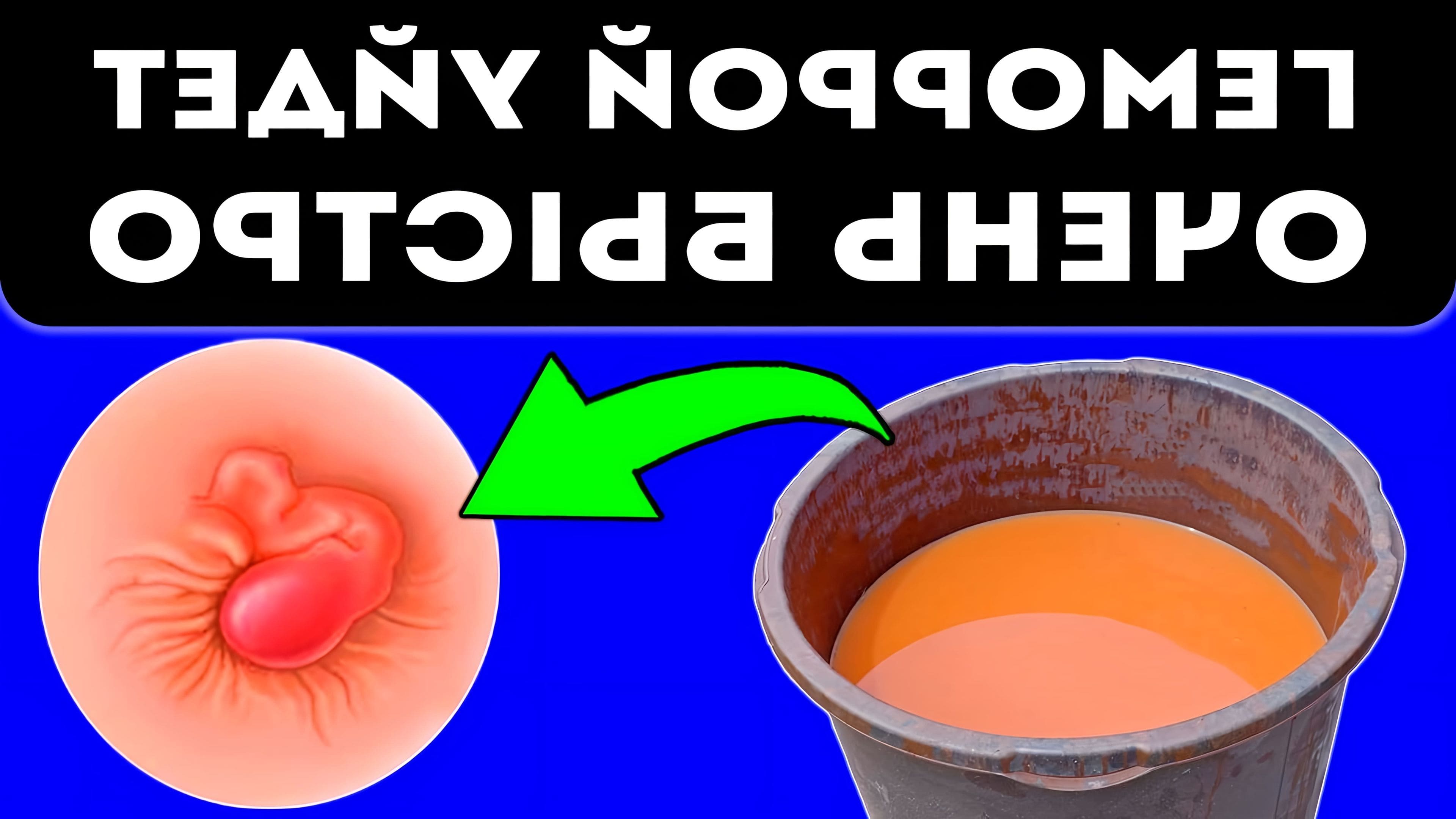 Народные средства от геморроя быстро. Народные средства от геморроя быстро. Геморрой народная медицина. Травы от геморроя народные средства. Рецепт от геморроя.