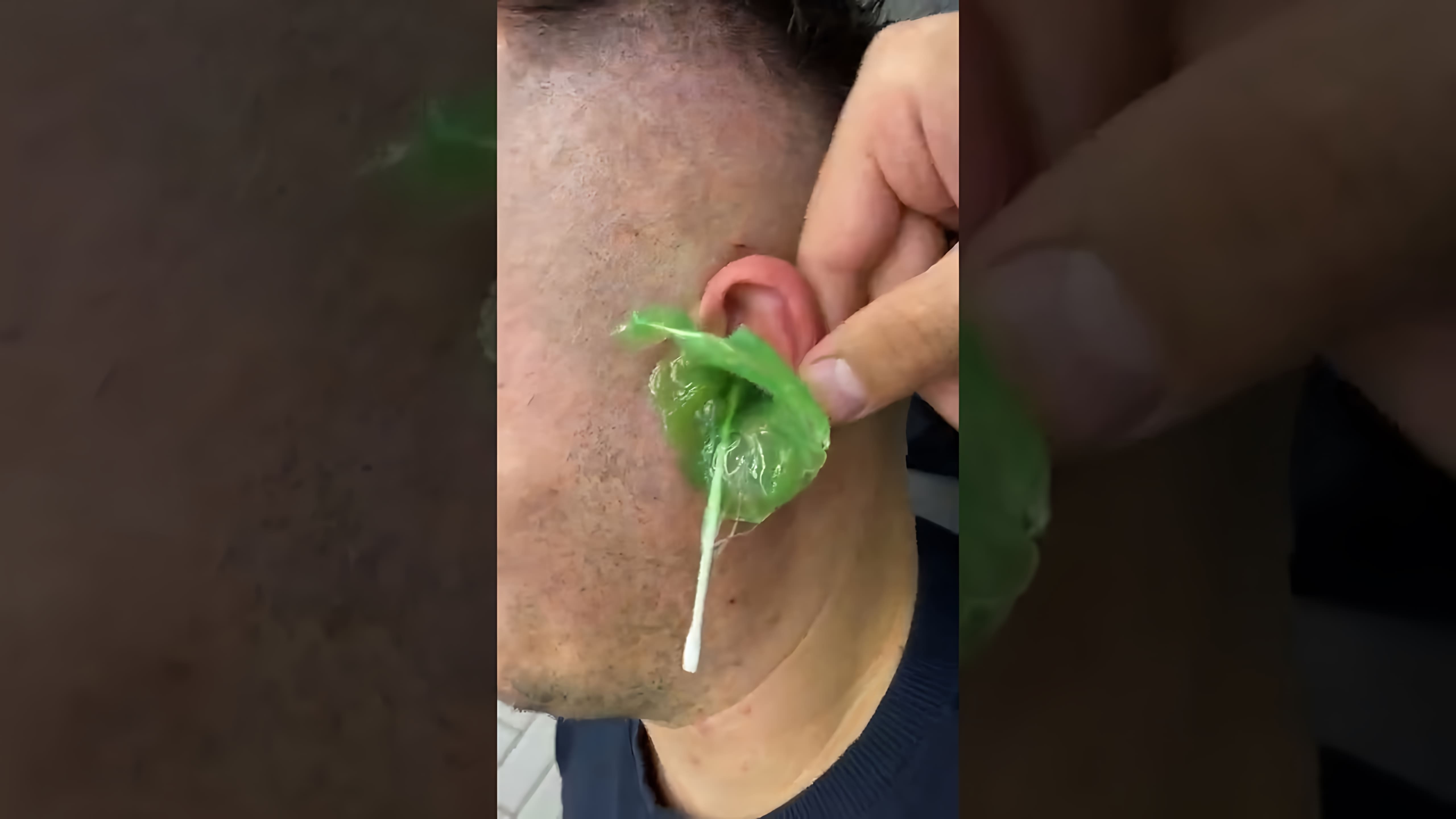 В этом видео-ролике будет показано, как правильно чистить уши