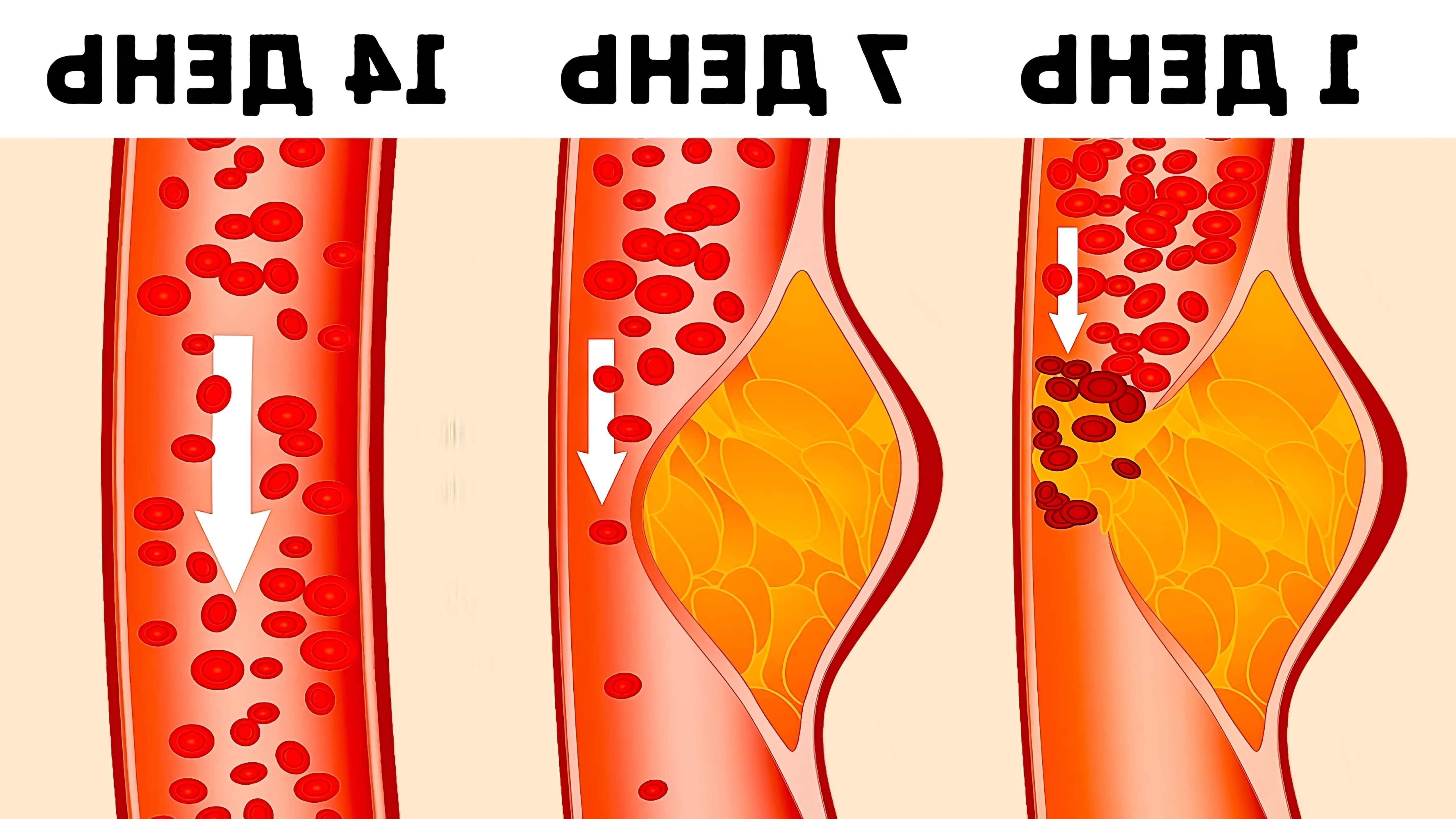 Диета DASH (Dietary Approaches to Stop Hypertension) - это план питания, разработанный специально для снижения артериального давления у гипертоников