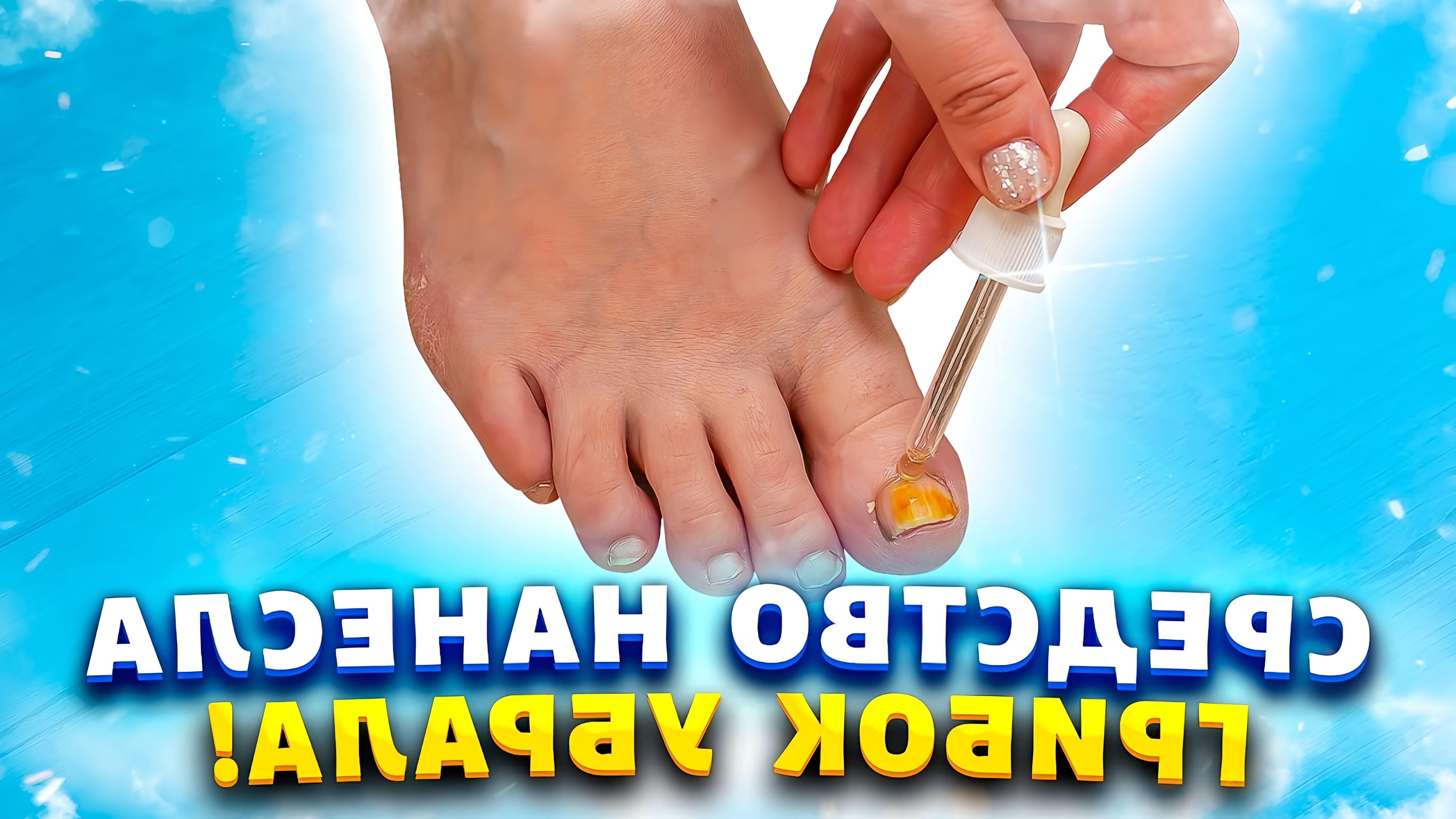 В этом видео Марина Жукова рассказывает о своем опыте борьбы с грибком ногтей и кожи